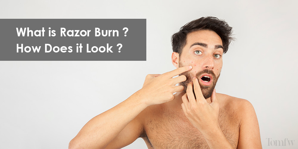 how-to-get-rid-of-razor-burn-fast